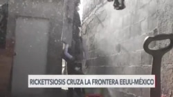 Aumentan muertes por rickettsiosis en Baja California