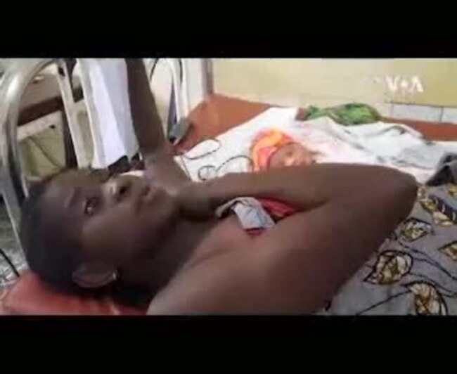 Kobota na ntonga ya mpasi te to accouchement par péridurale