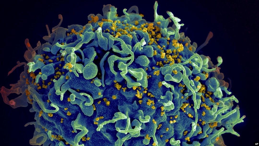 Foto de archivo: Una célula T, en azul, siendo atacada por el VIH, en amarillo. (Seth Pincus, Elizabeth Fischer, Austin Athman/Instituto Nacional de Alergias y Enfermedades Infecciosas/NIH vía AP)