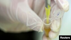 Los casos sucedieron en los últimos dos meses, durante el mismo periodo en que el país ha experimentado una oleada de enfermedades respiratorias graves vinculadas al virus.